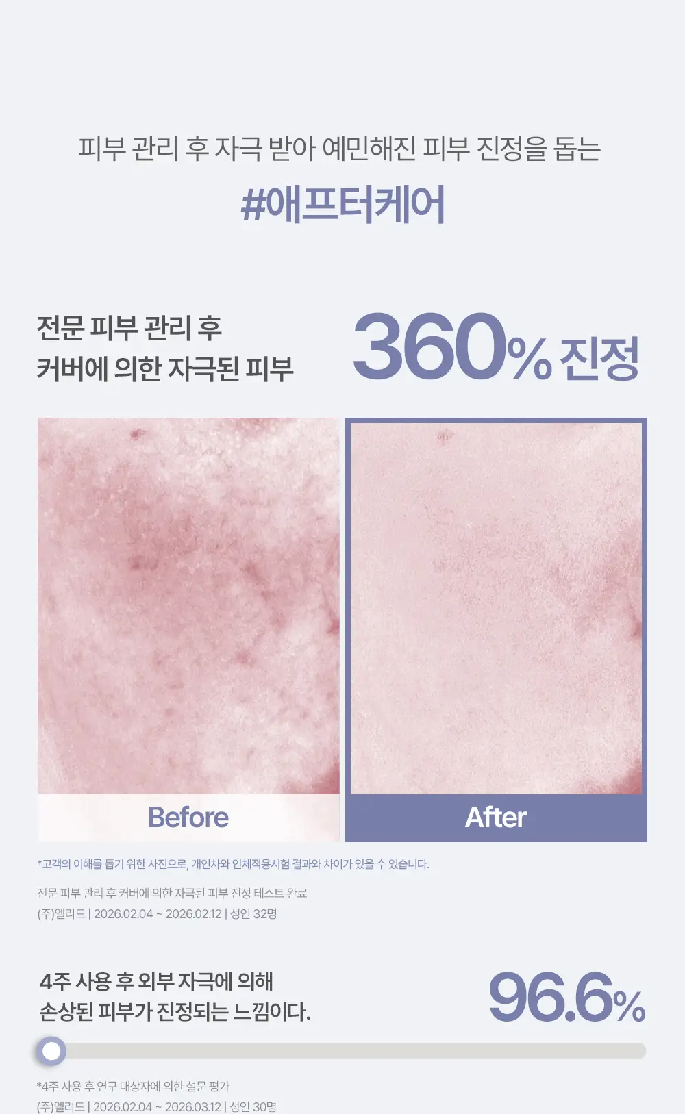 [에스트라 공동개발/5월 올영픽] 에스쁘아 더마커버 블레미쉬 밤 40g 2colors (+에스트라 클렌징폼) 상세페이지 11